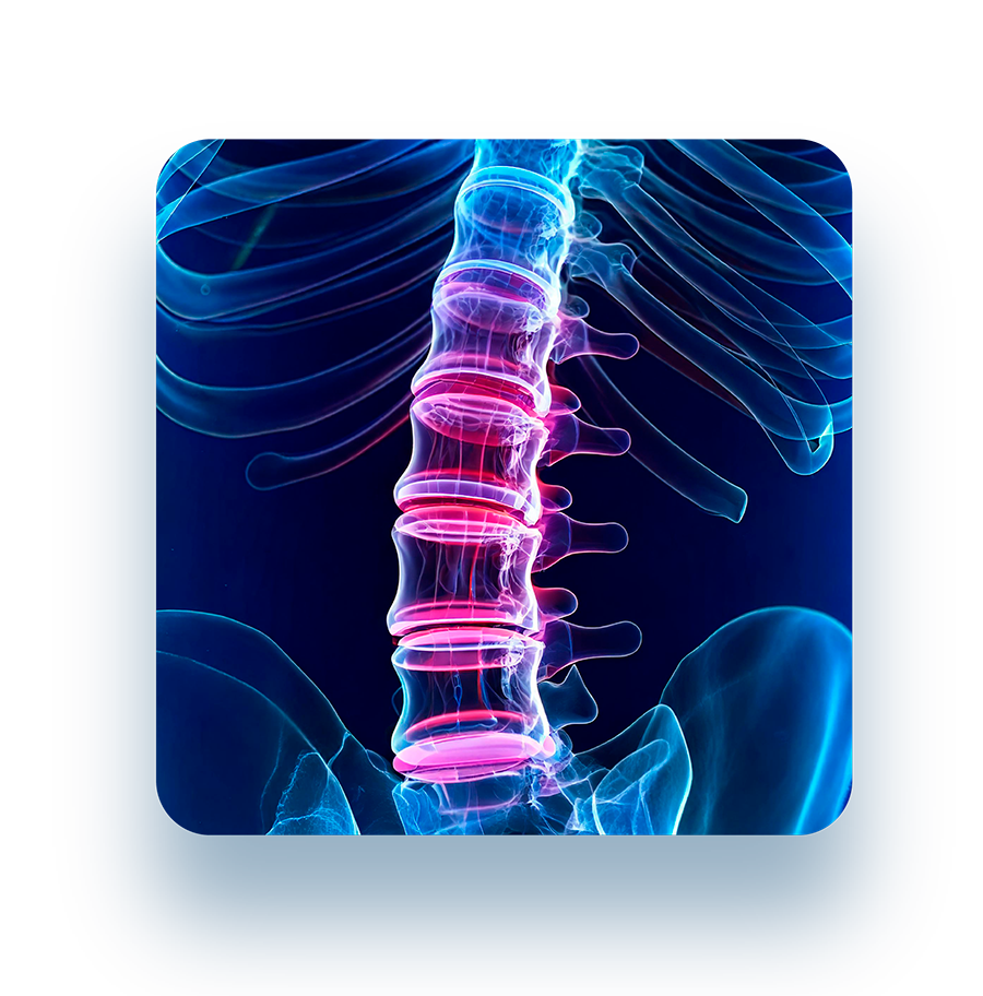 Degenerative Disc Disease