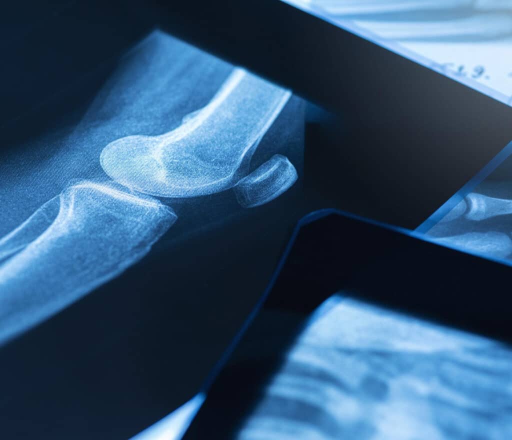 Regenerative Relief image