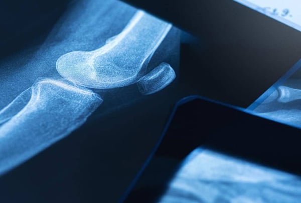 Non-Surgical Orthopedic