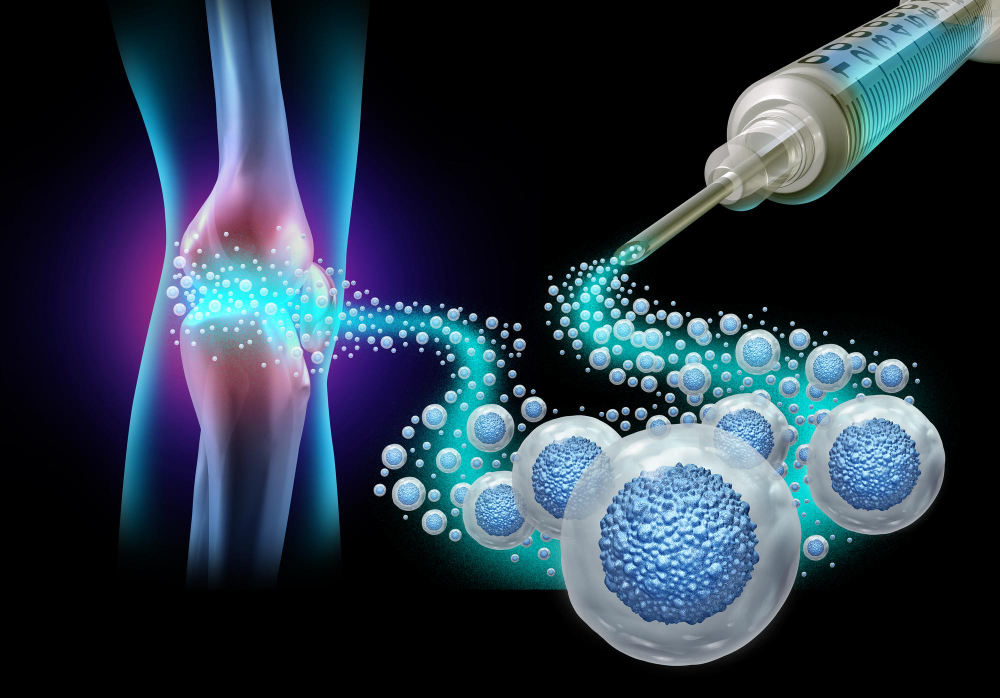 How Orthopedic Stem Cell Therapy Works